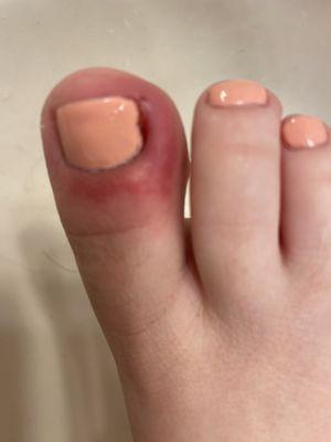 Day after daughters pedicure