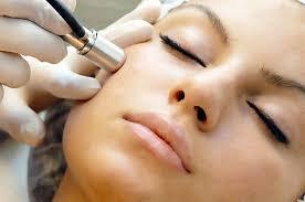 Microdermabrasion Facial