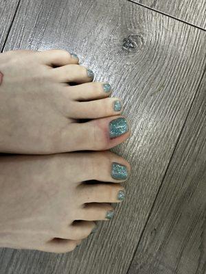 Can you tell which toe is infected next day?