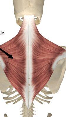 Most trigger point pain happens here