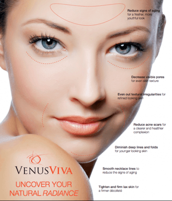 Venus Viva is three skin treatments in one!