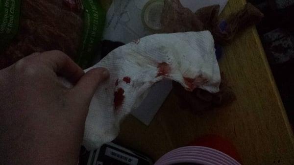 Many bandages and paper towels with blood.