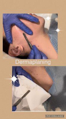 Dermaplaning to exfoliate and remove vellus hair!