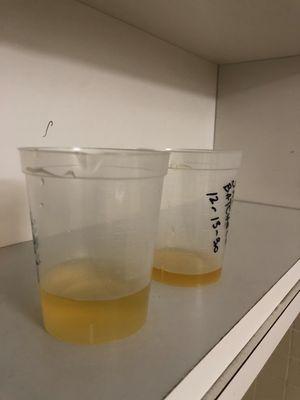 Uncovered urine samples with personal ID information.