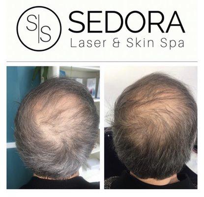 Sedora Medical Spa