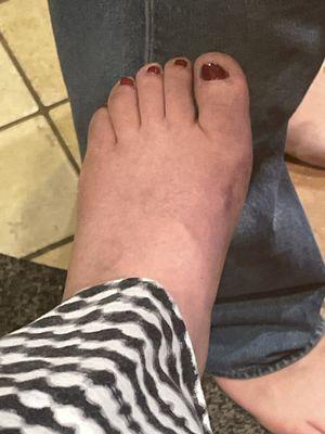 My pedicure