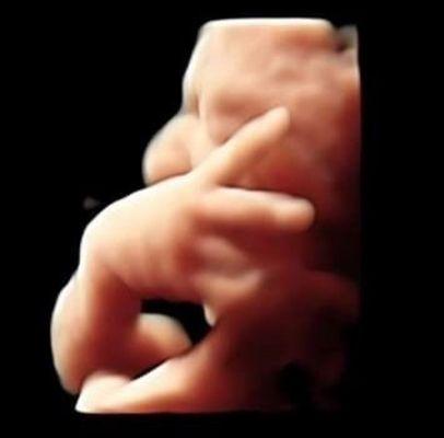 Baby throwing out peace sign 24 weeks pregnant in HD Live ultrasound