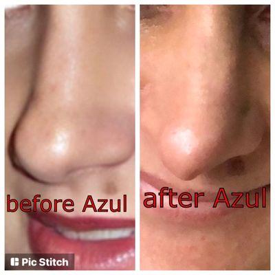 Azul Plastic Surgery