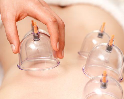 cupping