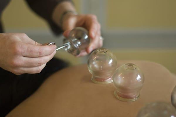 cupping therapy is used to relieve muscle tension.