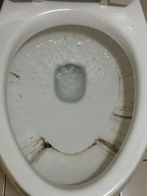 Dirty toilet