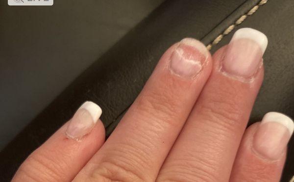 Broken nail