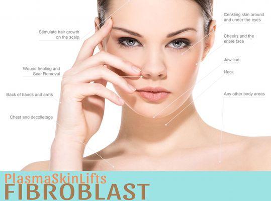 Fibroblast Plasma Skin Tightening