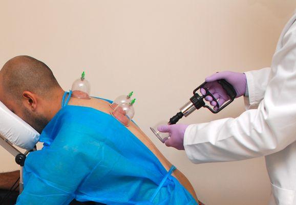 Bay Area Hijama