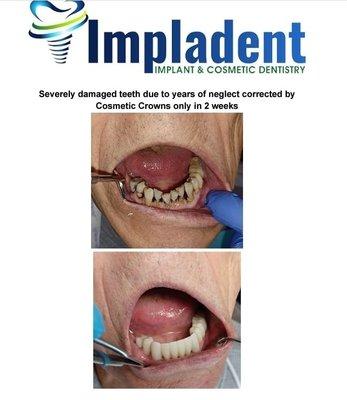 Impladent Implant & Cosmetic Dentistry Anaheim, CA