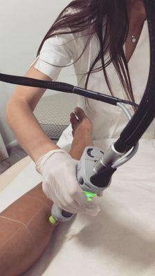 Ladies laser hair removal