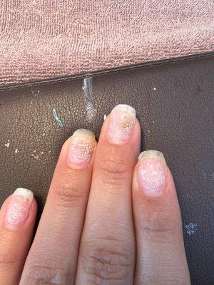 Nails grew mold