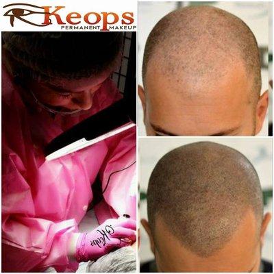 Improving your Head Appearance with Scalp Micro-Pigmentation @ Keops Permanent Make Up