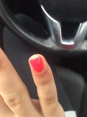 On the pinky you can kind of see a brown/dark reddish line under the cuticle where it had been bleeding.