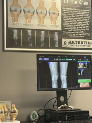 Arthritis Knee Pain Centers Houston