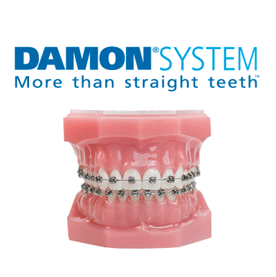 Damon braces provider.