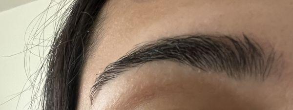 Multiple patches missing in the stem of the brow