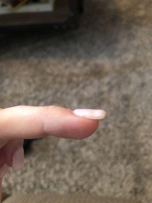 Bubbly uneven nail