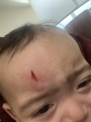 Son's injury due to negligence in the child care center