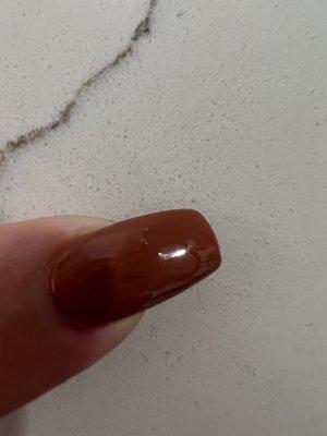 Lint or hair stuck in nail