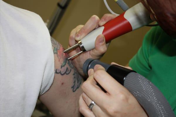 Vanish Laser Tattoo Removal And Skin Aesthetics