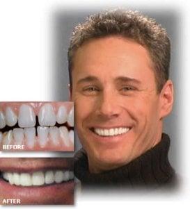 Park Place Dental at Edison Lakes