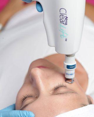 ClearLift Laser Face Lift