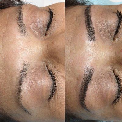 Microblading