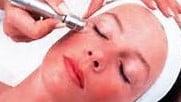 Resurface with Diamondhead microdermabrasion.