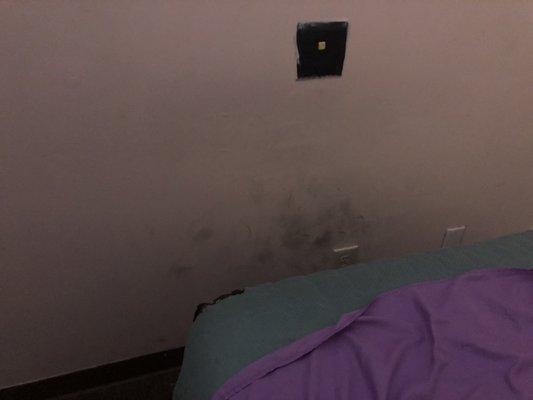 Dirty walls and ripped bedding for massage bed