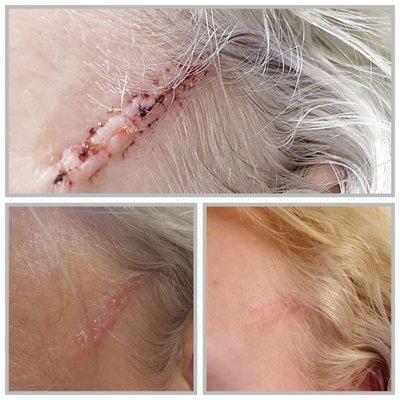 Dermatologic Surgery of the Carolinas