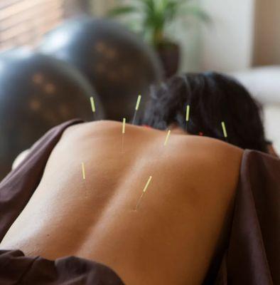 Red Pine Acupuncture