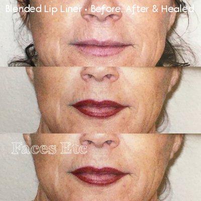 Blended Lip Liner - Before, After & Healed