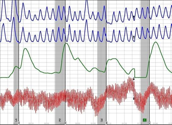 Polygraph Chart