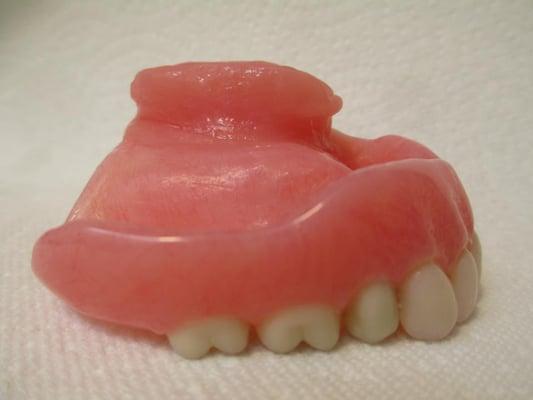 One of our more unusual cases, this obturator is designed to fit a patient who had surgery, which left a void in the palate.