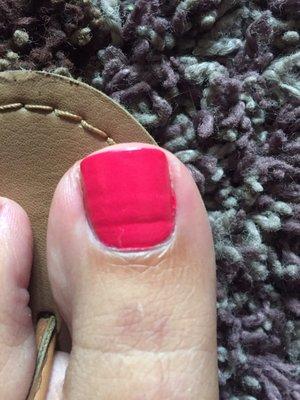 Weird indent on big toe but it's not my actual toe nail. Not sure how this even happens?!