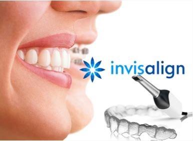 Invisalign provider