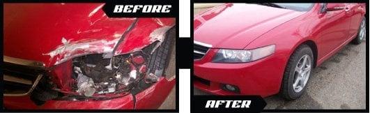 Acura TL Before and After