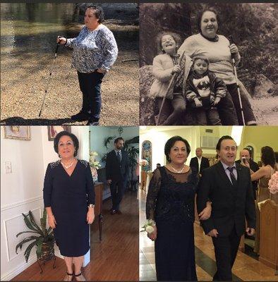 Zaric had severe knee problems, and walked with a cane when she came to Best Weight.  She has lost over 60 lbs, and is still going! Congrats