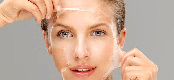 Chemical Peels