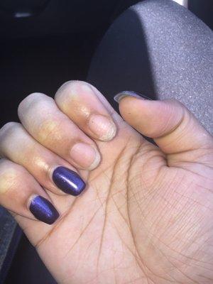 More nails that popped off on other hand.