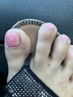 Worst gel pedicure I've ever had