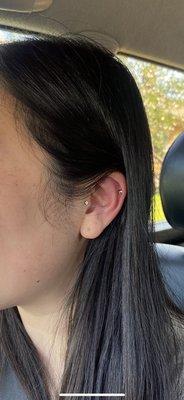 cubic zirconia studs on both tragus (jewelry change) & helix (new piercing) - immediately after.