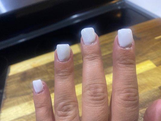 Horrible nails!