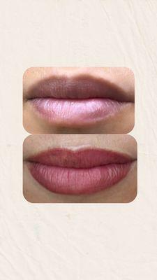 Dark Lips Neutralization